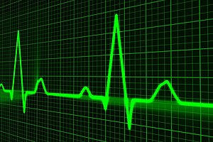 Grüne Pulsspur an einem medizinischen Gerät